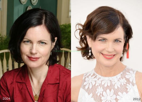 Elizabeth Mcgovern plastic surgery