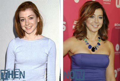 Alyson Hannigan Boob Job