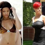 Rihanna Boob Job (Breast Implants) Before & After