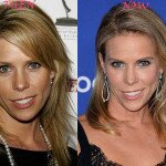 Cheryl Hines Plastic Surgery Before and After