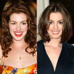 Anne Hathaway Nose Job Before and After