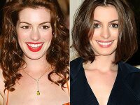 Anne Hathaway nose job before and after