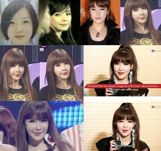 Park Bom plastic surgery