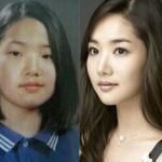Park Min Young Plastic Surgery Before and After