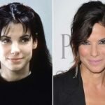 Sandra Bullock Plastic Surgery Before and After