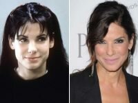 Sandra Bullock plastic surgery before and after