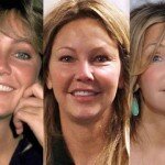 Heather Locklear Plastic Surgery Before and After