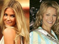 Jennifer Hawkins plastic surgery before and after