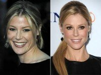 Julie Bowen plastic surgery before and after