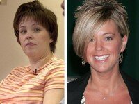 Kate Gosselin plastic surgery before and after