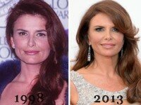 Roma Downey plastic surgery before and after