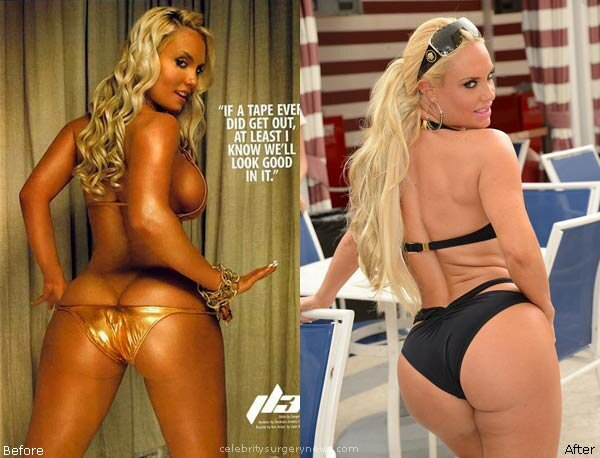 Coco Austin plastic surgery before and after