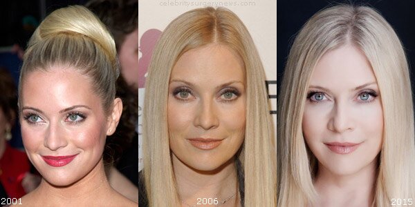 Emily Procter plastic surgery before and after
