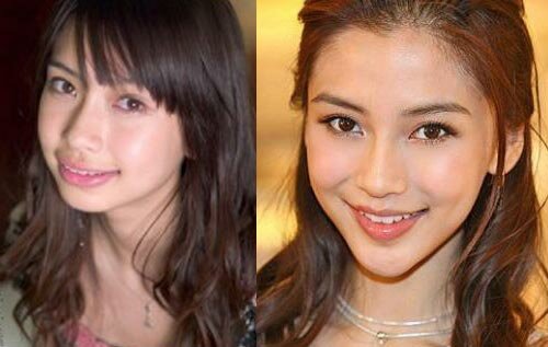 Angelababy before surgery