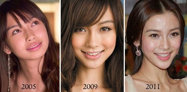 Angelababy plastic surgery before and after