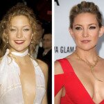 Kate Hudson Boob Job Before and After