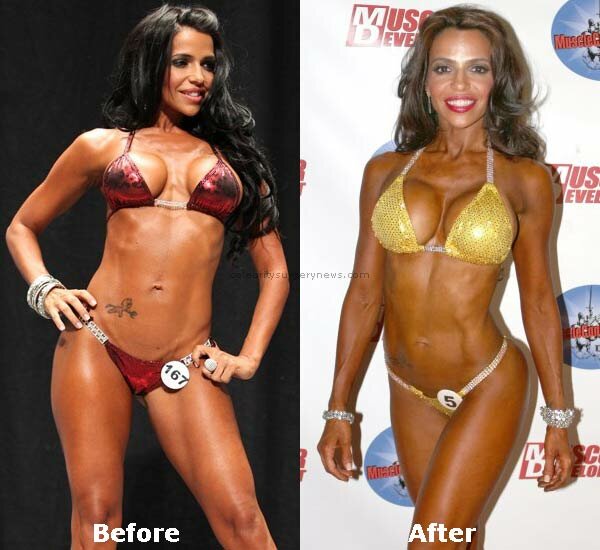 Vida Guerra plastic surgery before and after